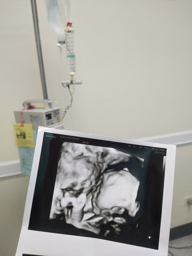 อัพเดจครรภ์ 26 สัปดาห์