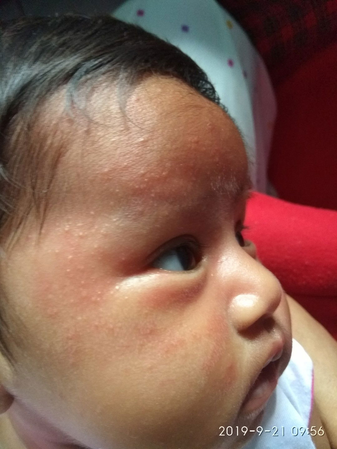 bintik" pada wajah baby