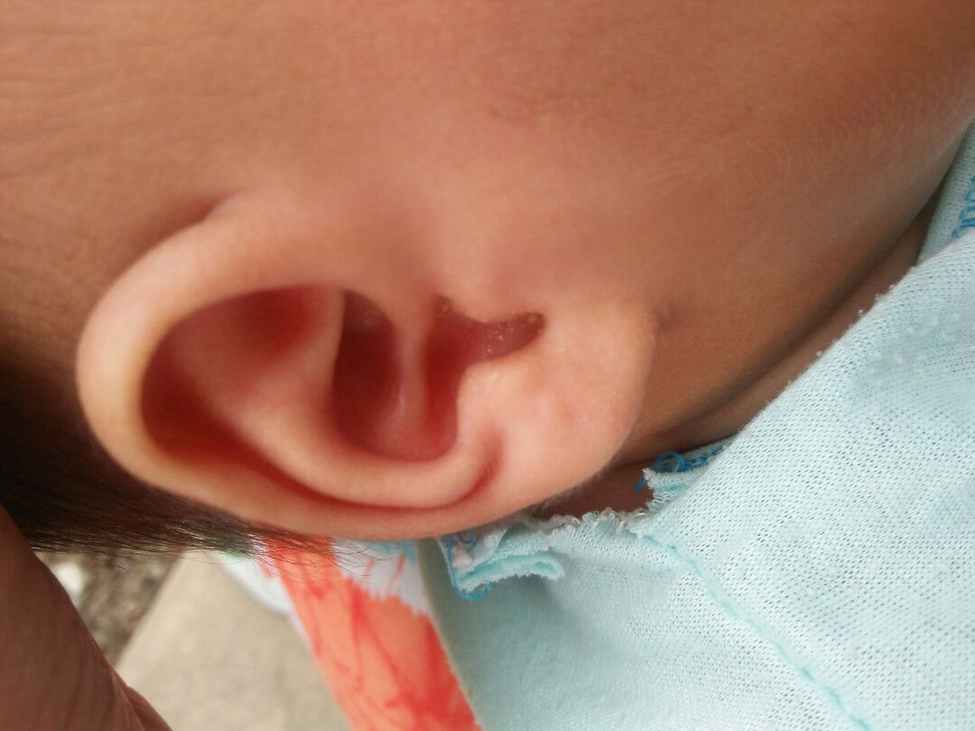 keluar cairan warna kuning