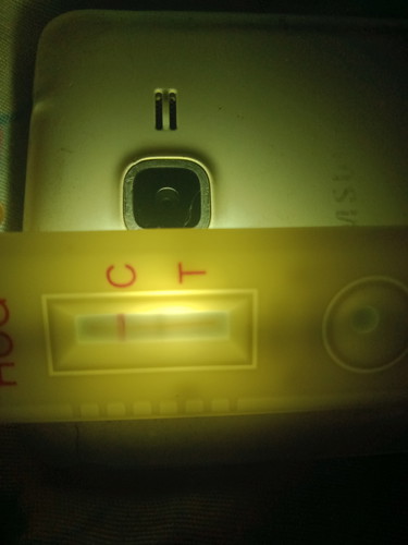 แบบนี้มีสิทธิ์ได้ลุ้นมั่ยค่ะ