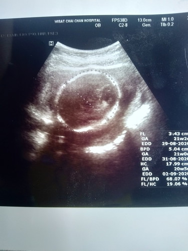 ญหรือชค่ะ มองไม่เห็นเรย