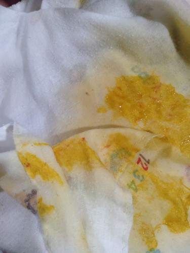 ลูกอึมีเลือดปนจะเป็นอะไรมั้ยครับ