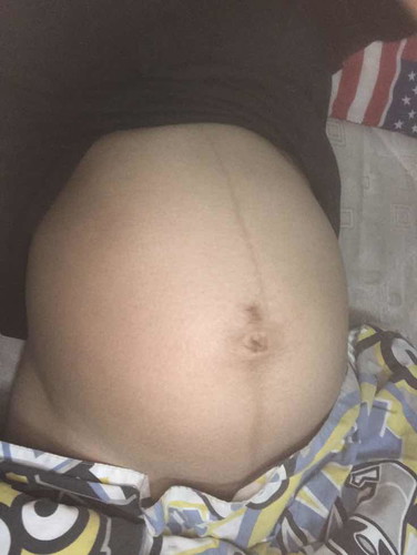 34 week 5 day