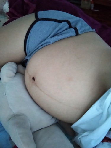 33week