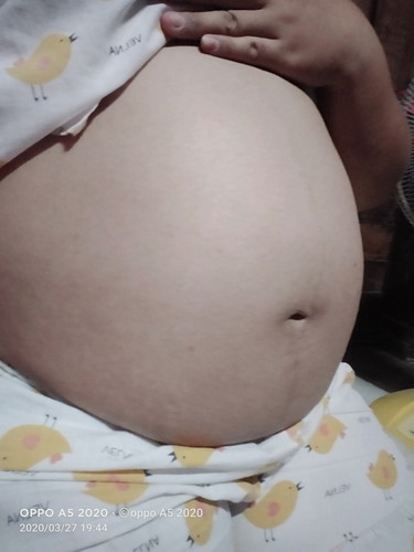 34วีคน้องดิ้นเบา