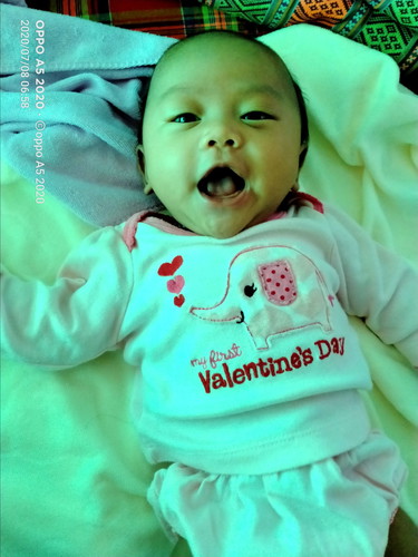 ลูกไม่ดูดขวดนม🍼