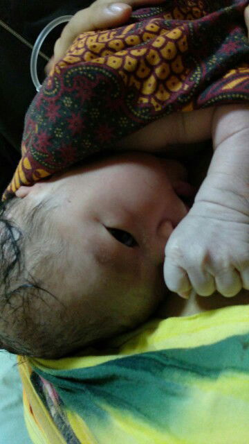 Kelahiran Putra kami tgl 31 july 2020 , lewat HPL 41 minggu 1 hari.