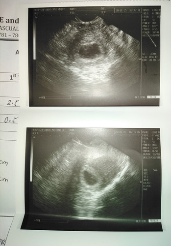 CURIOUS OF 7WEEKS PREGNANCY