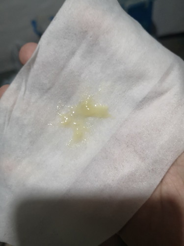 is this normal?