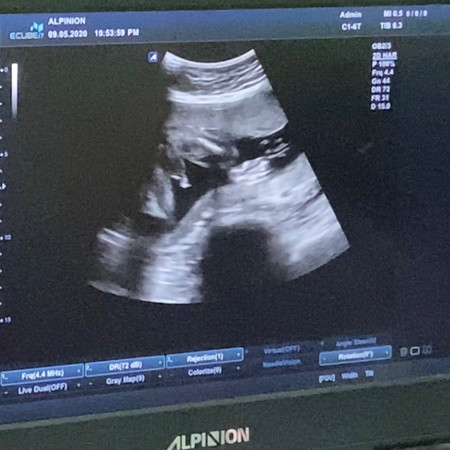 ลูกชาย❤️
