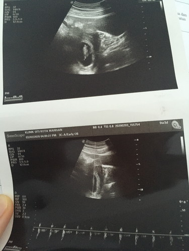 Scan minggu ke8 yang mendebarkan