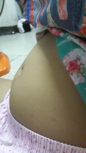 อายุครรภ์