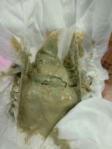 อุจจาระลูก