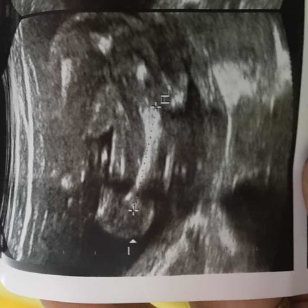 อยากรู้เพศลูก