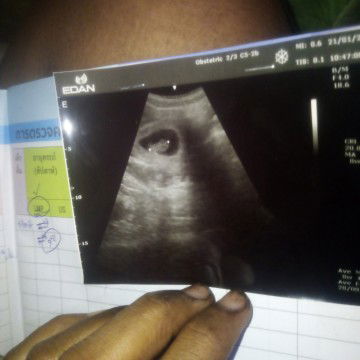 ตั่งครรภ์​