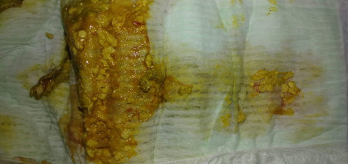 3 weeks baby poop