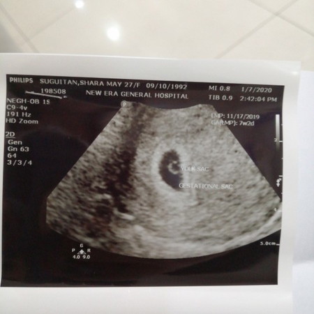 5 Weeks And 6 Days Preggy