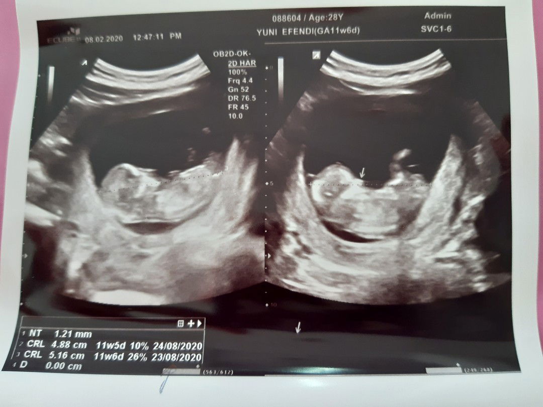 Unii Bebeii profile icon