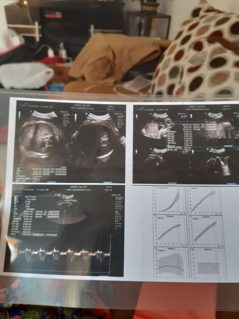 lebih baik induksi atau tidak