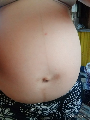 tummy??
