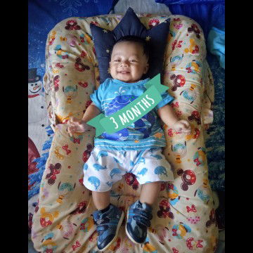 Telapak tangan dan kaki anak sering berkeringat?