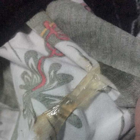 ถ้ามีมูกเเบบนี้ควรไปหาหมอมั้ยค่ะ