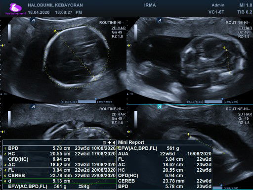 Berat badan bayi dalam kandungan