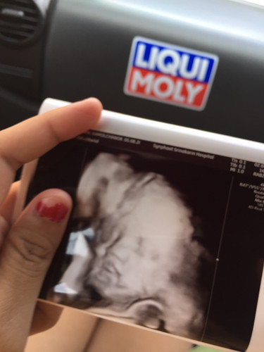 ลูก