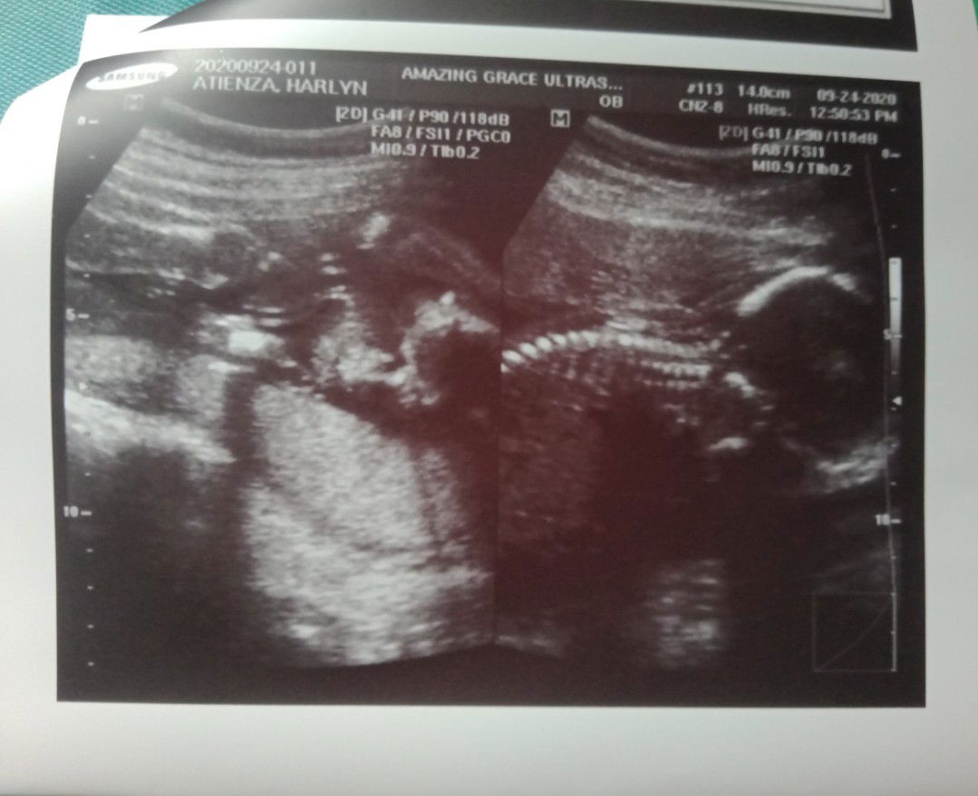 Harlyn Plemojer Atienza profile icon