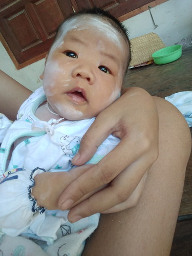 เด็กน้อย