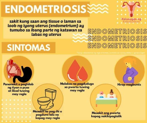 ENDOMETRIOSIS
