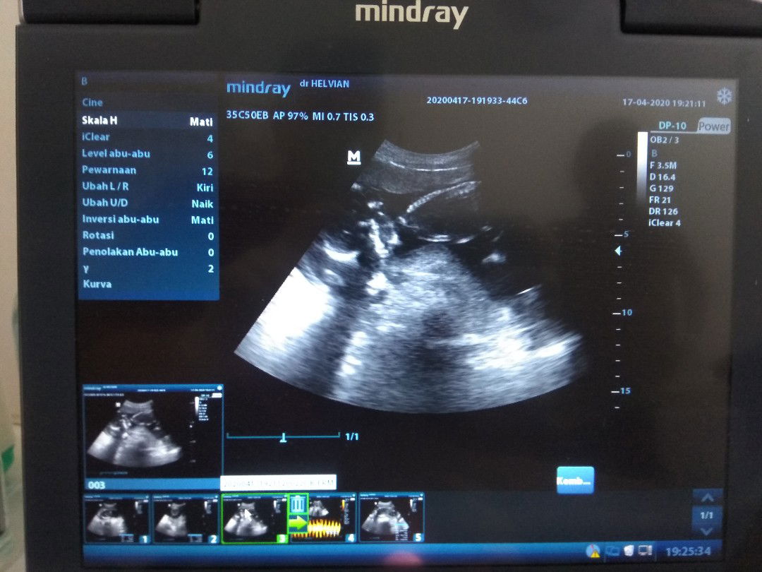 HPL SEPTEMBER 2020 🤗