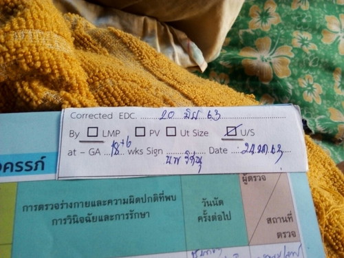 อันนี้ใช้หมอนัดคลอดไม่ค่ะ