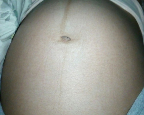 ดิ้นแรงมากเลยค่ะ