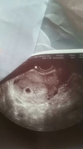 5weeks and 1 day