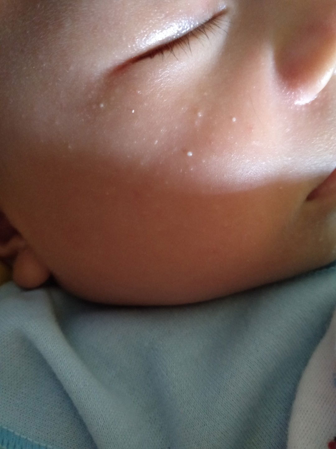 pipi seperti nanah tapi bukan nanah