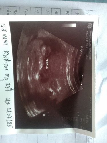 ช่วยดูเพศลูกให้หน่อยได้ไม๊ค่ะ