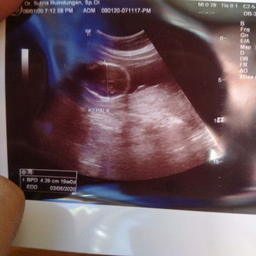 posisi janin
