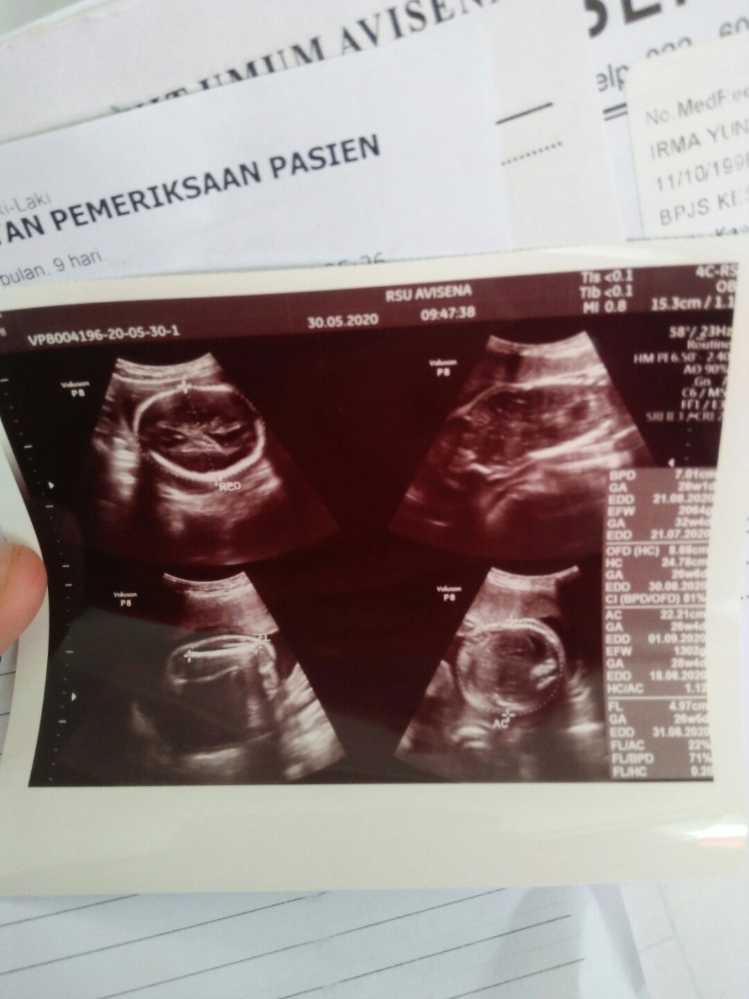 sedih, sakit hati, kecewa