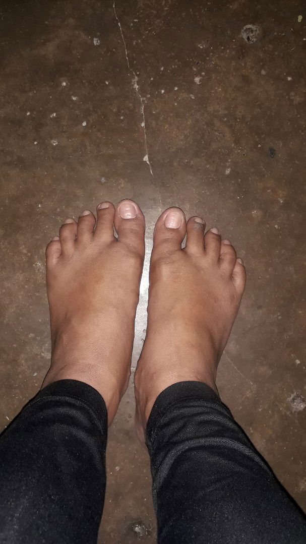 bengkak kaki saat hamil 18 minggu