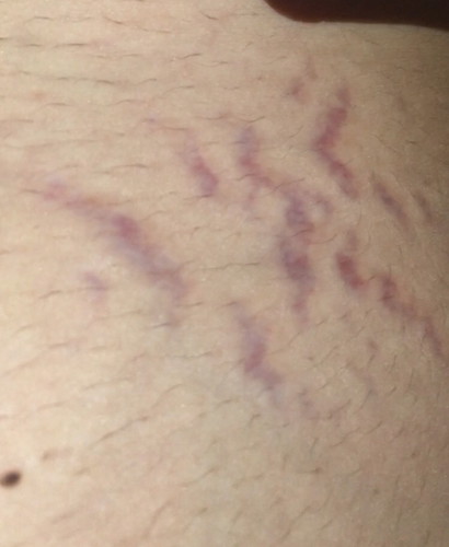 33 weeks and 5 days.