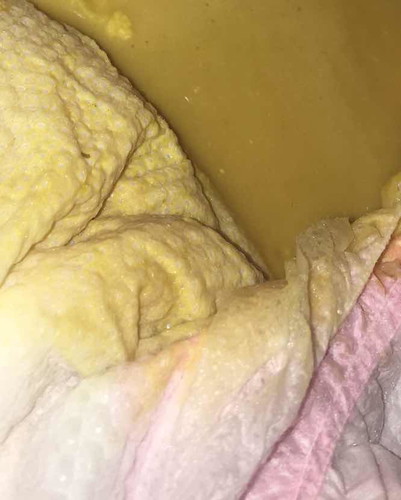 Normal lang po ba etong poop ni baby?