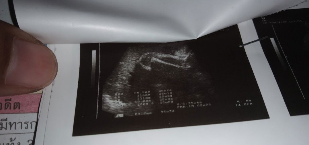 แม่ดูนำ้หนักลูกที่ไหนค่ะ