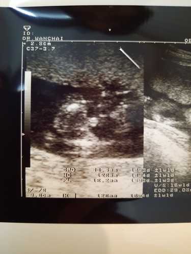 16weekแล้วค่ะแม่ๆ