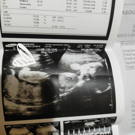 Boy or Girl?