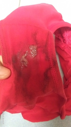 เลือดล้างหน้าลูกมีจริงหรอ ?