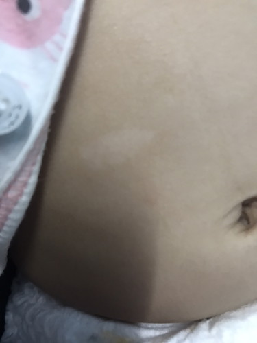 ด่างขาว