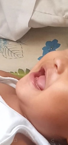 teeth ni lo (pasagot po plssssss thank you) ftm po