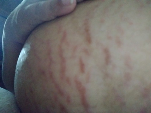 ขอถามหน่อยค่ะพอดีท้องแรก. 35+6