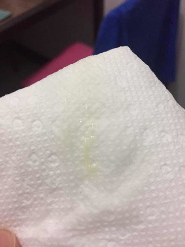 Mucus plug?